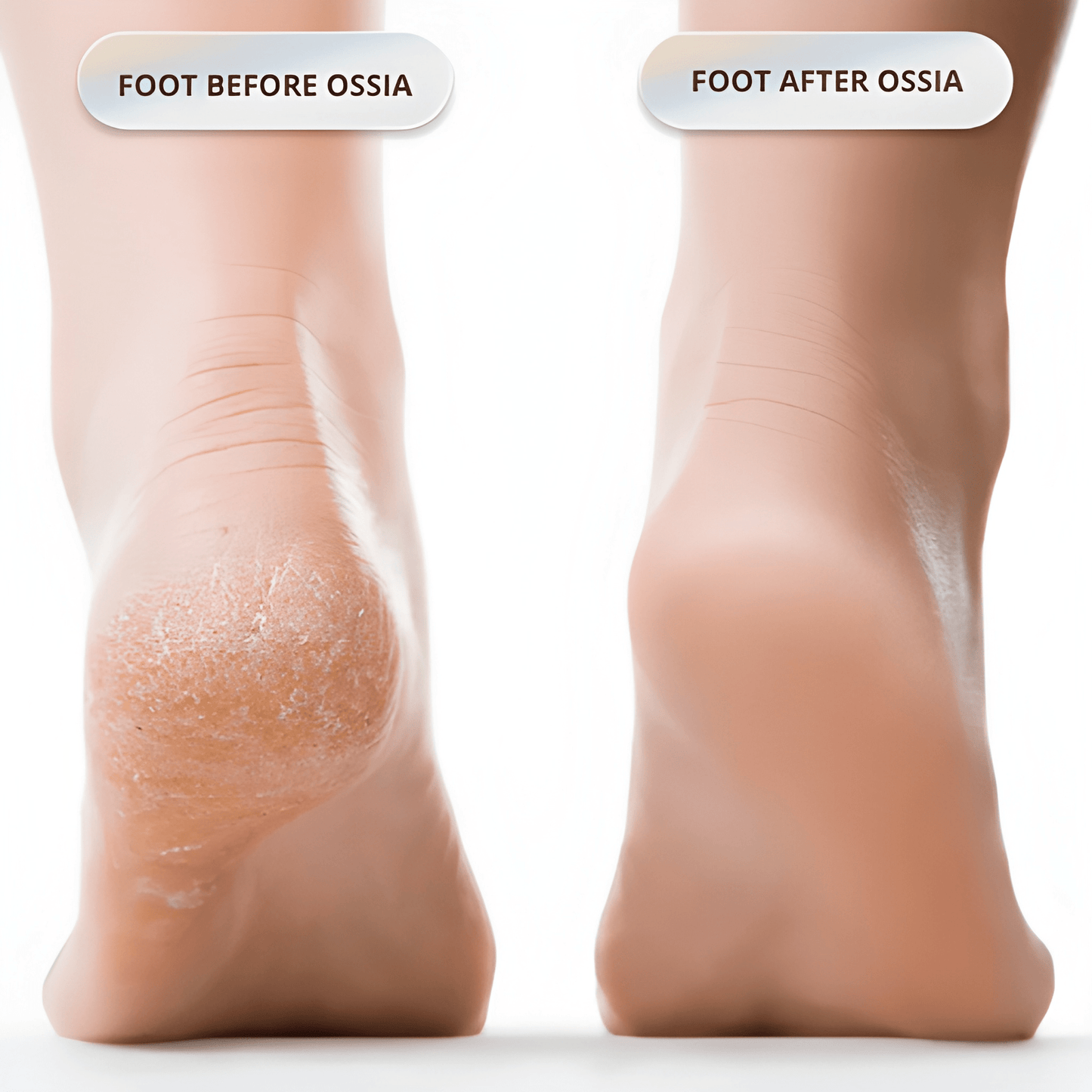 Ossia™ Silk 3 Pro Plus