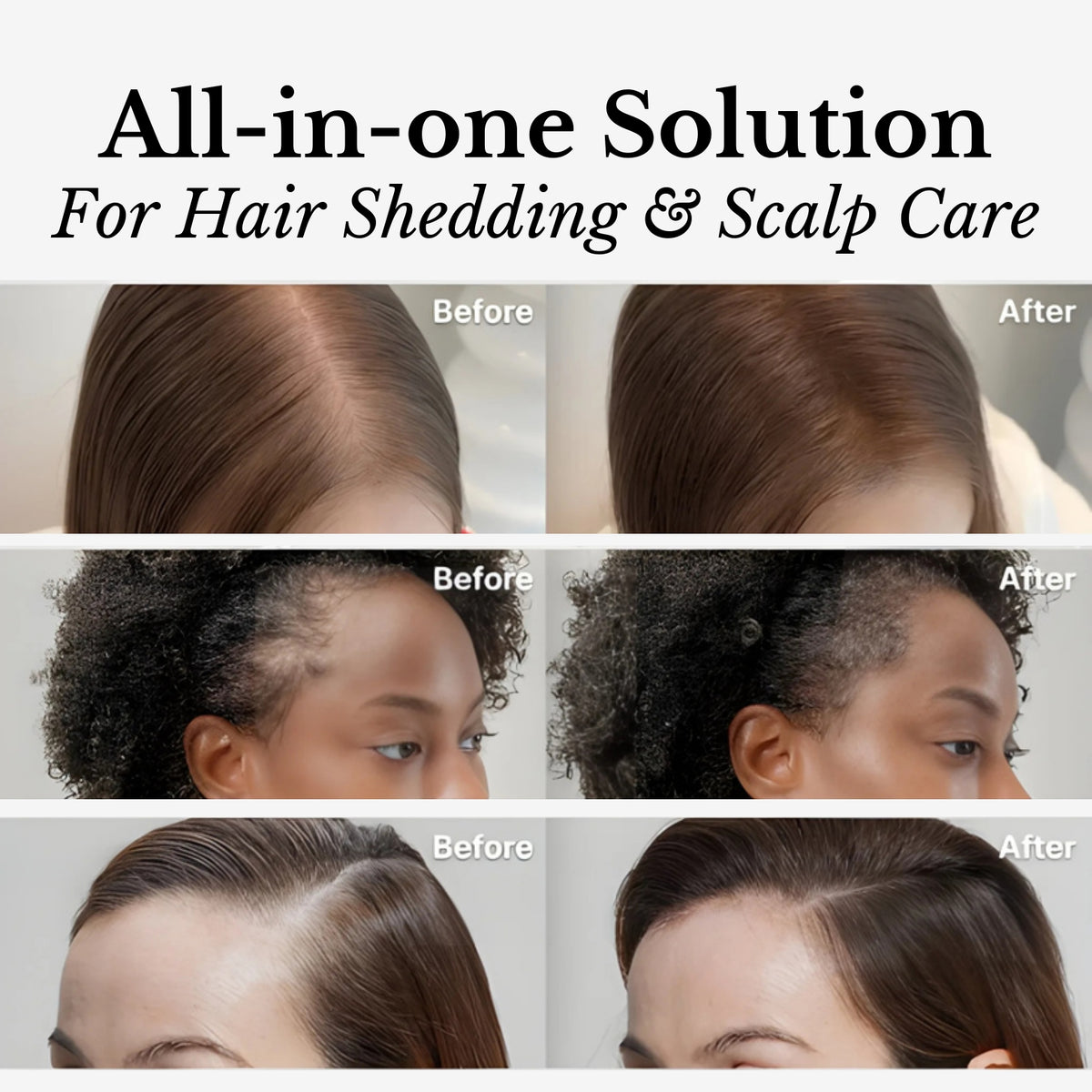 Lilyeve Hair Growth Brush Ampoule