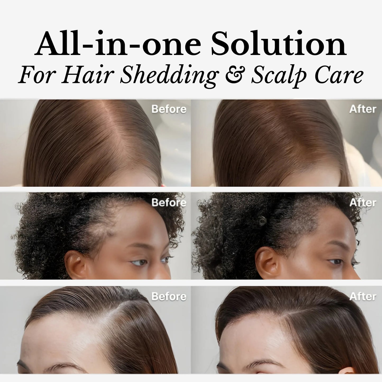 Lilyeve Hair Growth Brush Ampoule