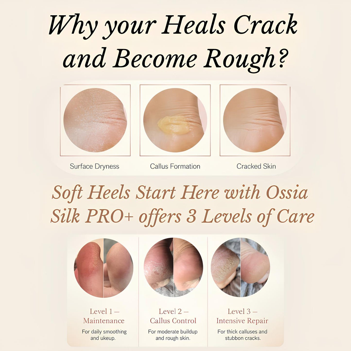 Ossia™ Silk 3 Pro Plus