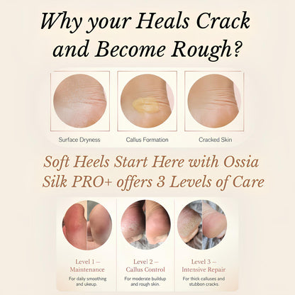 Ossia™ Silk 3 Pro Plus